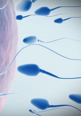 спермограмма төмен потенциалда